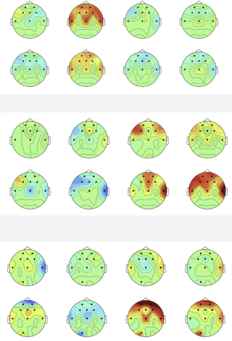 brain maps